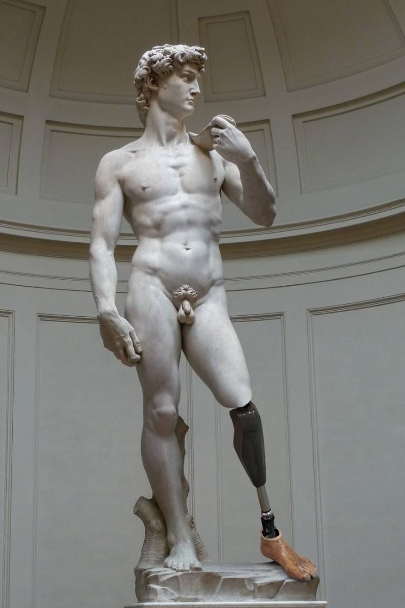 Michelangelo's David with a prosthetic lower leg