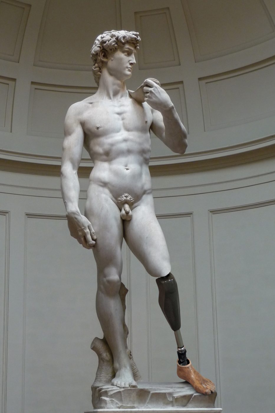 Michelangelo's David with a prosthetic lower leg